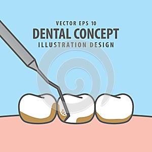 Square banner Scaling teeth illustration vector on blue background. Dental concept. photo