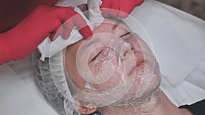 Squeezing out acne after the facial hydrogenation process.