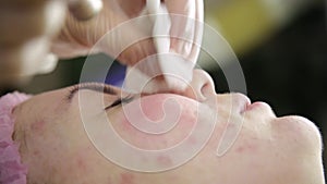 Squeezing pimple acne treatments. Young woman receiving beauty face therapy of cleaning pimple.