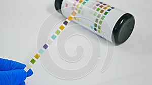 Srip test urinalysis in laboratory