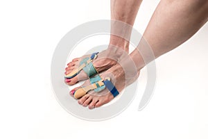 Stabilizing orthosis for the correction of the big toe on the woman legs when hallux valgus, 2 legs, close-up isolated, white