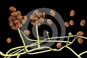 Stachybotrys chartarum mould