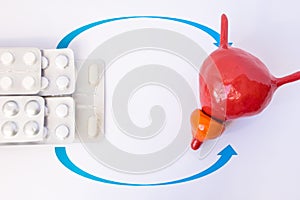 Stack of blisters with tablets or pill indicated by arrows in anatomic model of prostate gland and bladder. Concept photo of treat