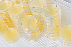 Stack of petri dishes with cultures in agar algae