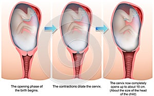 Stages of birth 3d medical  illustration