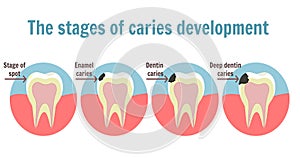 The stages of caries development. Dental toothache symbol