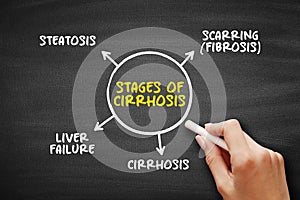 Stages of cirrhosis - scarring of the liver caused by long-term liver damage photo