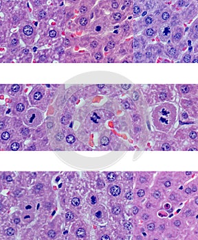 Stages of liver cellular mitosis photo