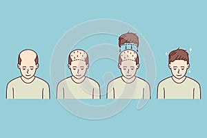 Stages of man hair transplant