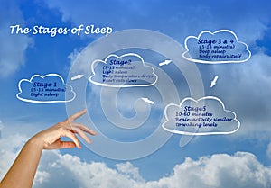 Stages of Normal Sleep