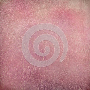 Stained pink grunge textured background