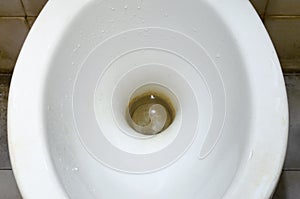 Stains and dirt do not clean the toilet bowl