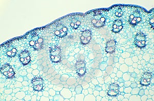 Stalk of a cereal cross-section under the microscope (Corn Stem