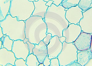 Stalk of a cereal cross-section under the microscope (Corn Stem
