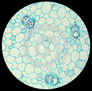 Stalk of a cereal cross-section under the microscope (Corn Stem