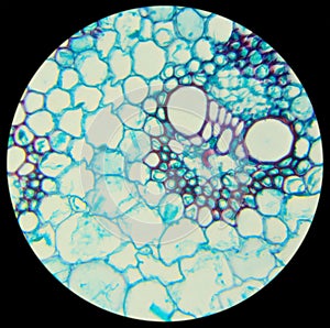 Stalk of a cereal cross-section under the microscope (Corn Stem