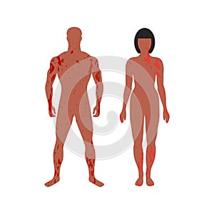 Standing adult man and woman with painful rash