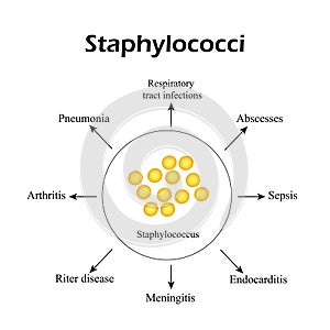 Staphylococci. Staphylococcus aureus causes diseases. Infographics. Vector illustration photo