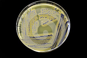 Staphylococcus aureus