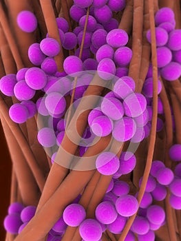 Staphylococcus aureus photo