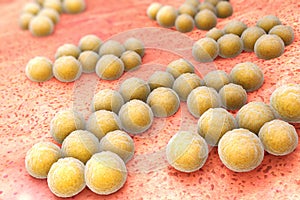 Staphylococcus aureus