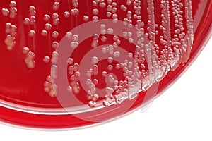 Staphylococcus aureus bacterial colonies on blood agar plate