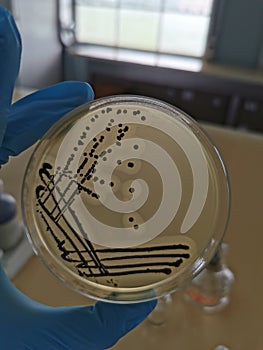 Staphylococcus aureus on Baird-Parker Agar