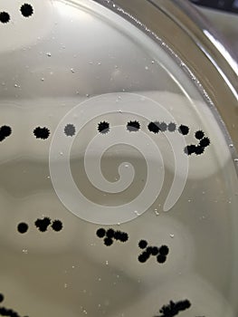 Staphylococcus aureus on Baird-Parker Agar