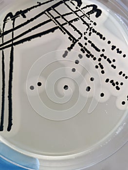 Staphylococcus aureus on Baird-Parker Agar