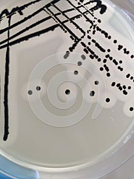 Staphylococcus aureus on Baird-Parker Agar