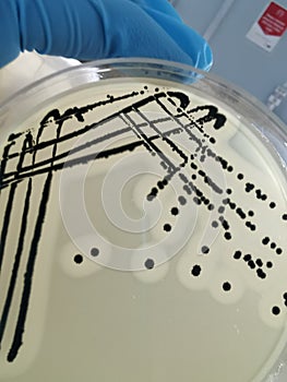Staphylococcus aureus on Baird-Parker Agar