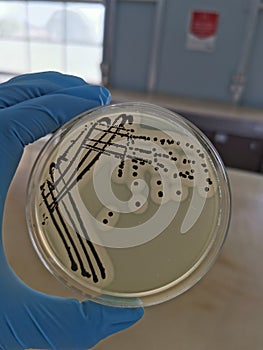 Staphylococcus aureus on Baird-Parker Agar