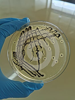 Staphylococcus aureus on Baird-Parker Agar