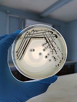 Staphylococcus aureus on Baird-Parker Agar