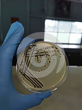 Staphylococcus aureus on Baird-Parker Agar