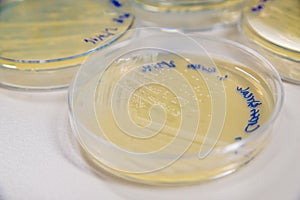 Staphylococcus aureus culture