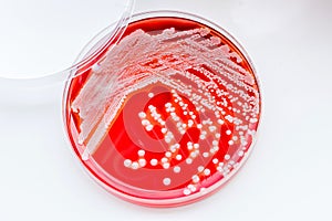 Staphylococcus aureus.