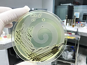 Staphylococcus aureus grow on baird parker agar. photo