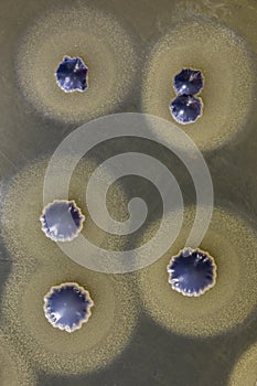 Staphylococcus aureus growing on Baird Parker