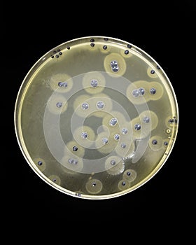 Staphylococcus aureus growing on Baird Parker