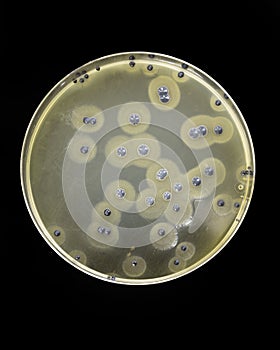 Staphylococcus aureus growing on Baird Parker photo