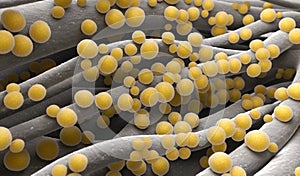Staphylococcus aureus MRSA photo