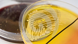 Staphylococcus aureus on petri dish