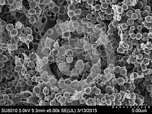 Staphylococcus aureus Scanning Electron Microscopy  photo