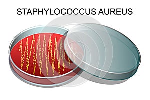 Staphylococcus aureus.v vector photo