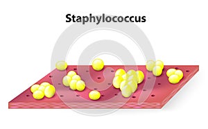 Staphylococcus colonies photo