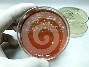 Staphylococcus and growth on blood agar. fungus mixed growth