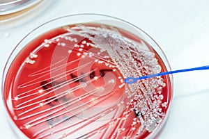 Staphylococcus speciesm( Staphylococcus aureus)