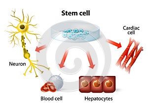 Stem cell application photo