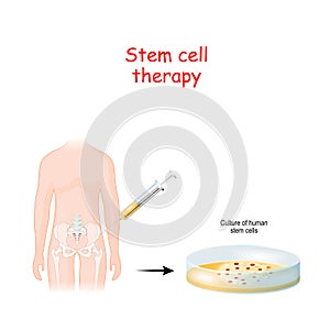 Stem cell therapy photo
